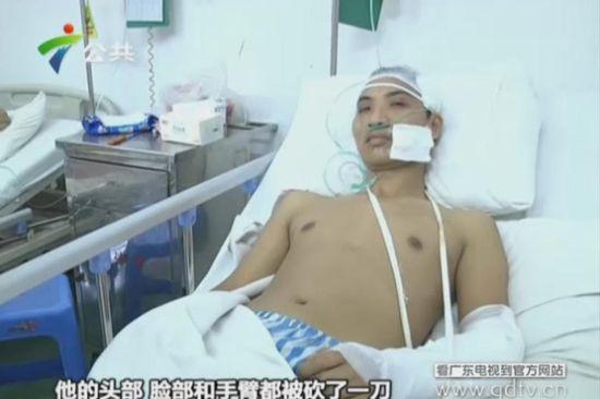 另一名傷者頭部、臉部和手臂都被砍了一刀。(視頻截圖)